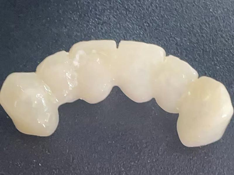 Што е „привремена круна“? Зошто ви треба еден?