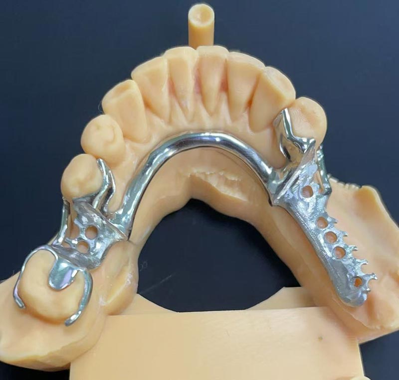 Предности на рамката за кобалт-хром (Рамка Co Cr)