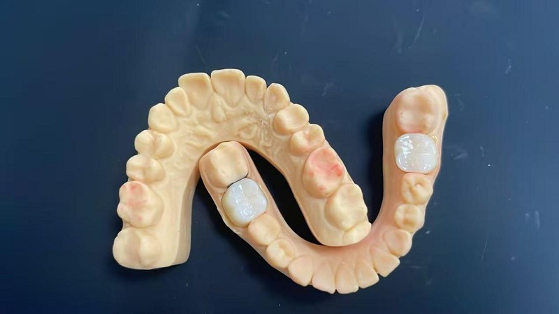 Што е раб на рамото?