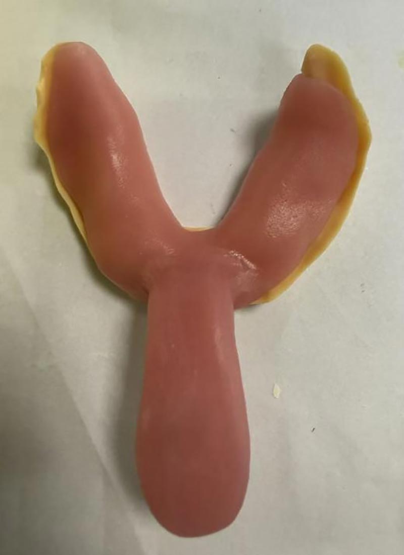 Работи што не сте ги знаеле за прилагодените стоматолошки фиоки