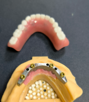 Локатор и стоматолошка лента
